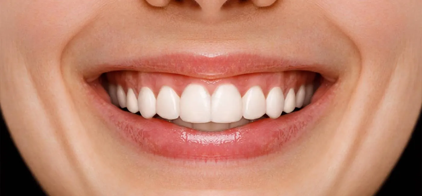 After professional teeth whitening at Smile Care Studio, Thunder Bay