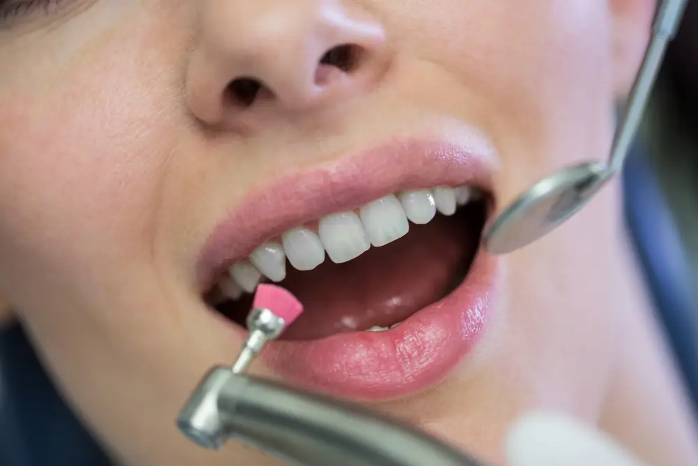 Deep cleaning & periodontal therapy